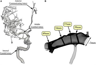 Validation of Patient-Specific Cerebral Blood Flow Simulation Using Transcranial Doppler Measurements